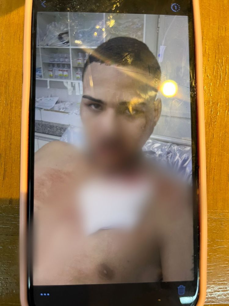 Criminoso que roubou empresário que buscava o filho na escola é baleado no rosto