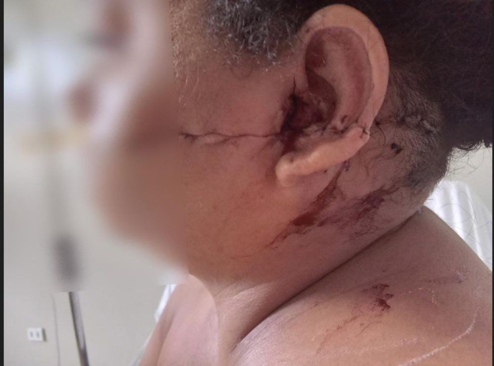 Foragido o Iapen é preso em Laranjal do Jari por tentar matar a ex-mulher