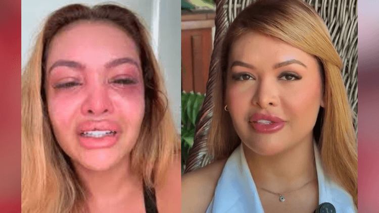 Caso Katiely: Ex-namorado de influenciadora do Amapá é condenado por violência doméstica