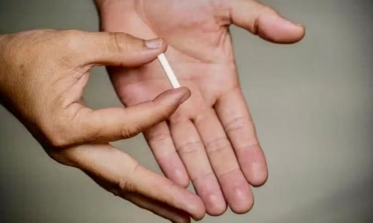 Implanon Chegou: Método mais eficaz para evitar gravidez já está disponível na rede pública de Macapá