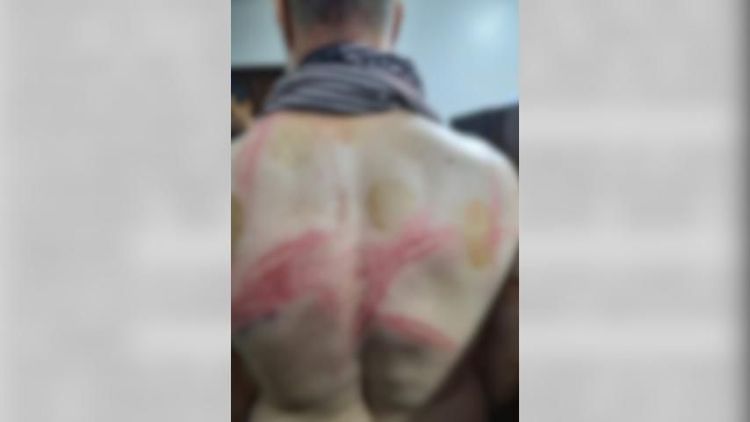 Oiapoque: professor da Unifap afirma ter sido agredido por PM’s durante carnaval