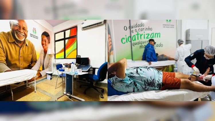 Com emenda de Dorinaldo, ambulatório da Unifap é reestruturado para tratar pé diabético