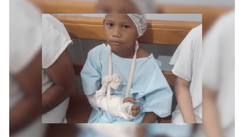 Criança atacada por cachorro passa por cirurgia e pode perder tato em 3 dedos