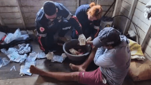 Ataque: Homem leva mordida de jacaré e perde parte da mão no AP