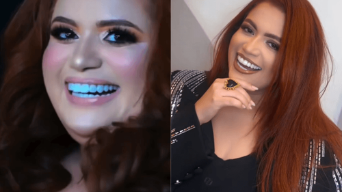 Nova fase: Após emagrecer 50 kg, Letícia Auolly passa por mudança radical no sorriso