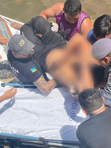 Policial civil é baleado na cabeça em Vitória do Jari