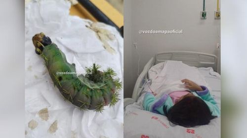 Perigosa e Venenosa: Menina é internada após picada lagarta Lonomia