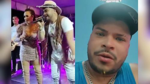 Varíola do macaco: Morte de cantor com Mpox em Belém acende alerta nos amapaenses