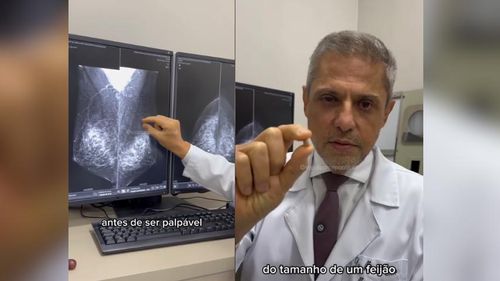 Câncer de mama: Você sabia que a prevenção e o diagnóstico precoce permitem 90% de chance de cura?