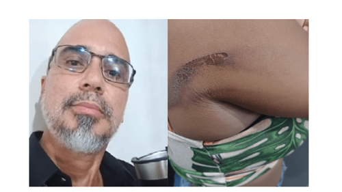 "Agressor do terçado" que bateu em adolescente  se apresenta a delegacia 