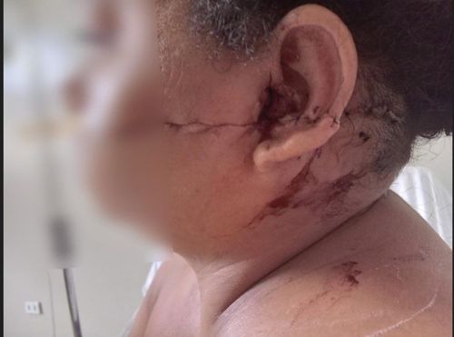 Foragido o Iapen é preso em Laranjal do Jari por tentar matar a ex-mulher