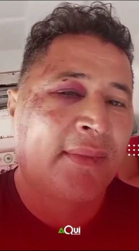 Vitória do Jari: comunicador morre após levar pauladas por não ter R$ 2